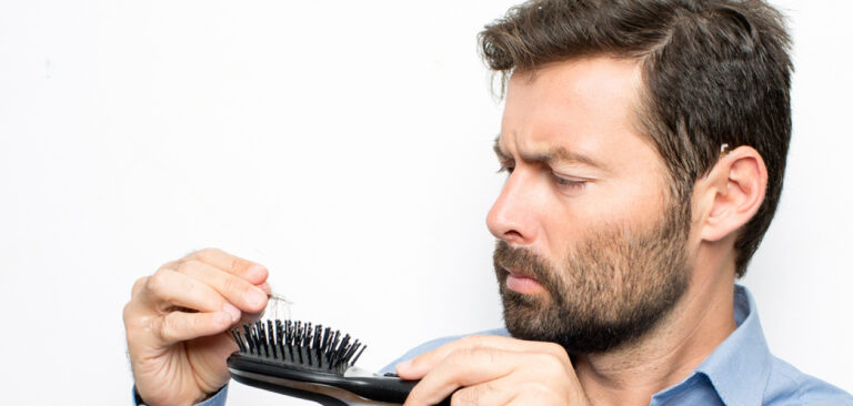 when to get a hair transplant